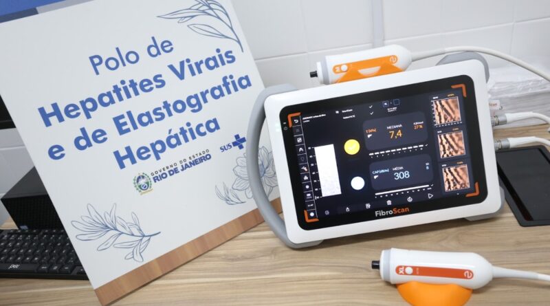 Estado instala tecnologia inédita para diagnóstico rápido de doenças no fígado