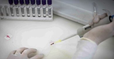 Ebola é descartado em paciente internado em São Paulo