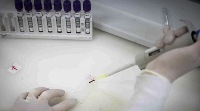 Ebola é descartado em paciente internado em São Paulo
